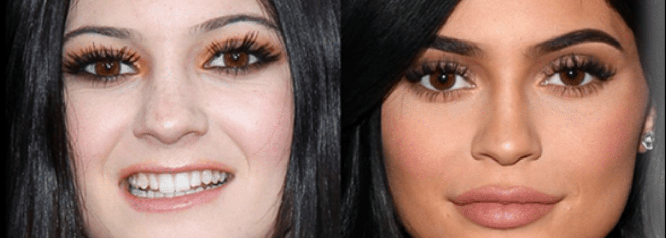 The Millennial – The Fastest Growing and Newest Patient Trend in Aesthetic Medicine